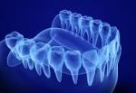 Risks of Denture Repair at Home